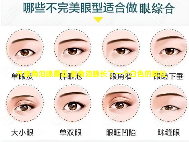 开眼角泪腺暴露 眼角泪腺长了一个白色的颗粒